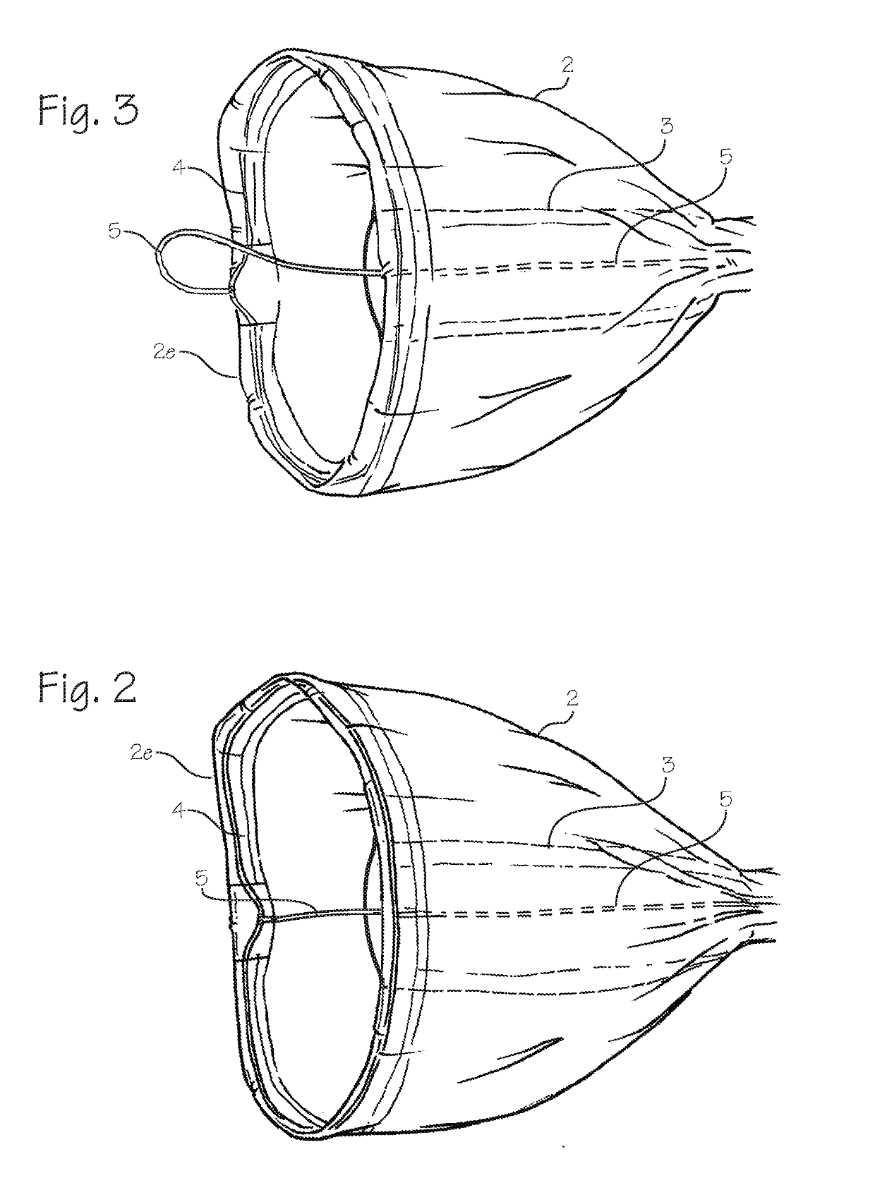 Specimen retrieval system for use in endoscopic surgery