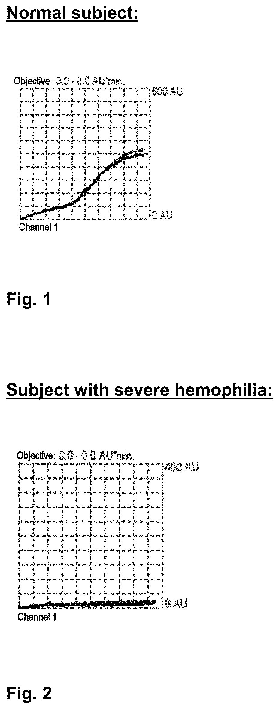 Method for diagnosing anomalies in the coagulation blood