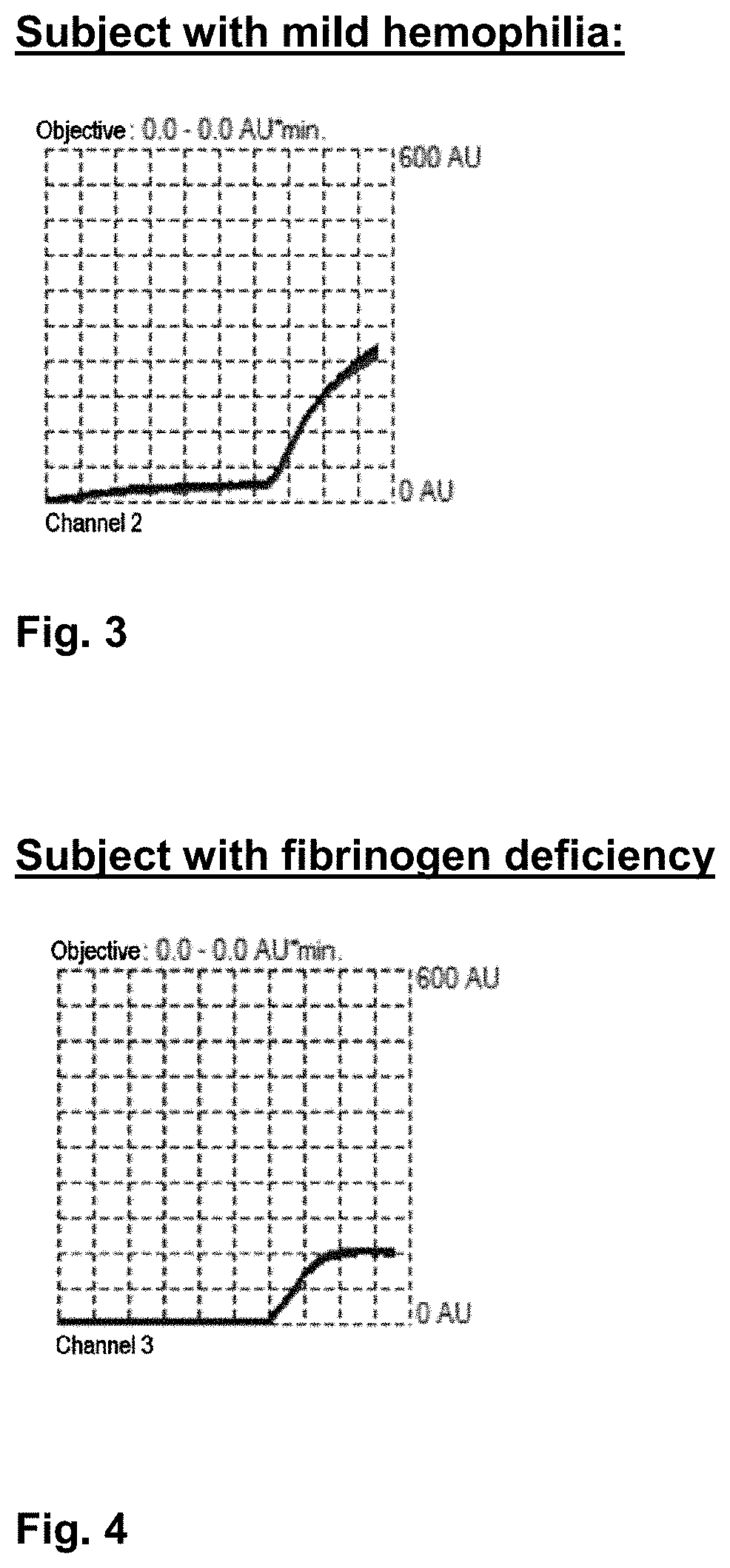 Method for diagnosing anomalies in the coagulation blood