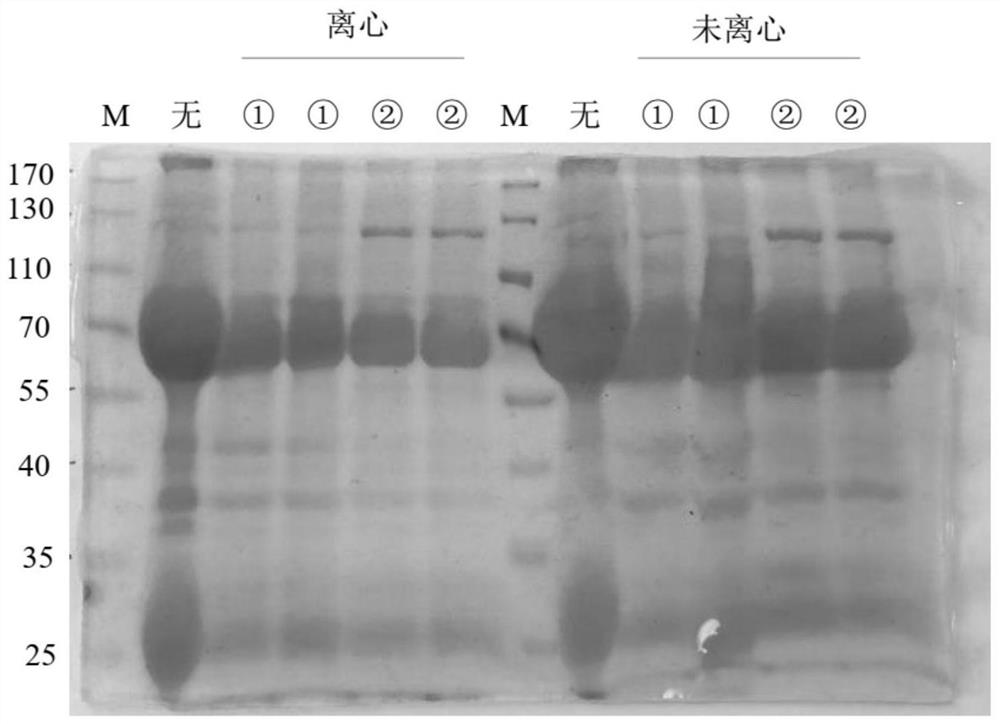 Porcine diarrhea associated virus tandem epitope protein induced egg yolk antibody and application thereof