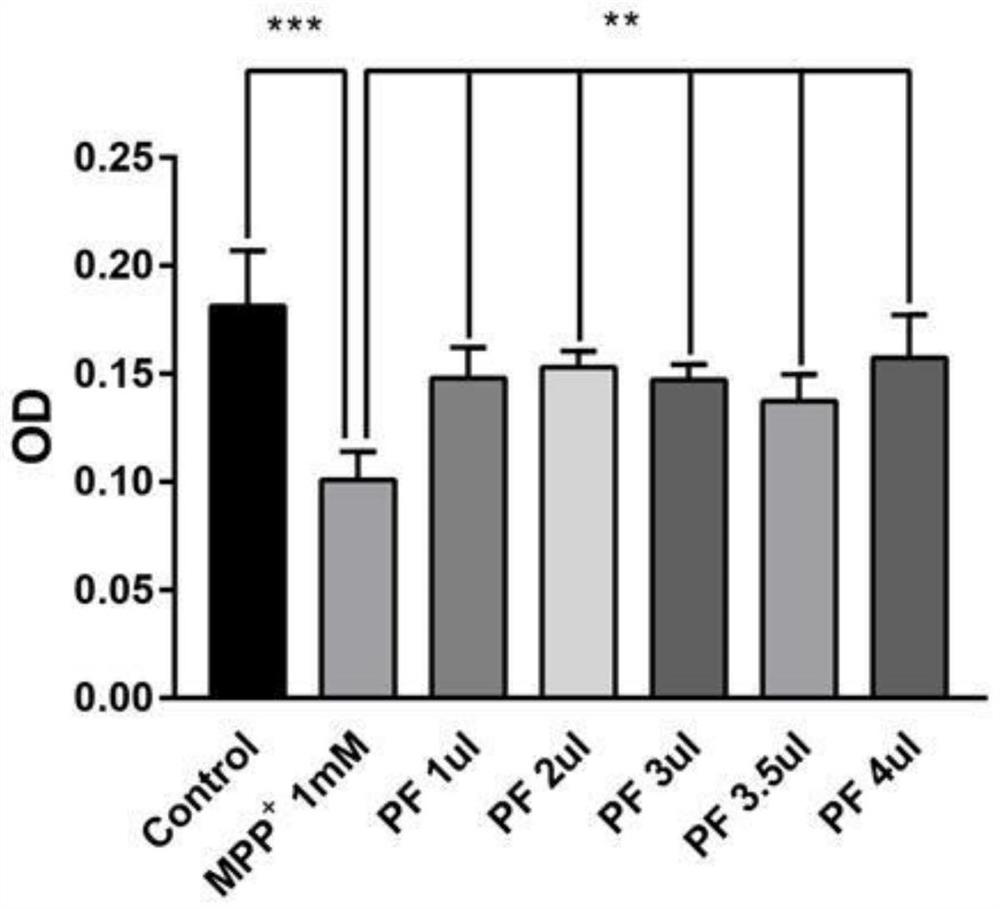 Application of S1P inhibitor in preparation of medicine for treating neurodegenerative diseases