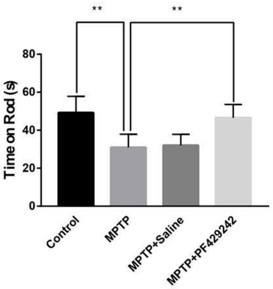 Application of S1P inhibitor in preparation of medicine for treating neurodegenerative diseases