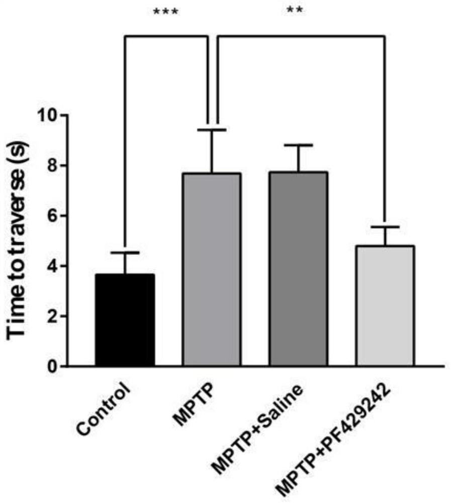 Application of S1P inhibitor in preparation of medicine for treating neurodegenerative diseases