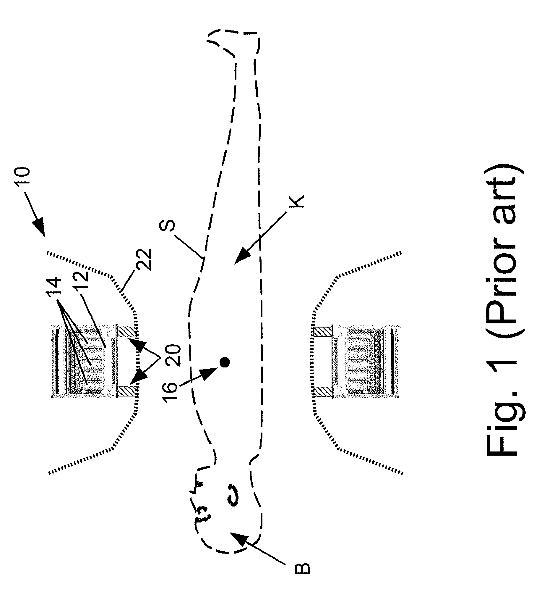 Large bore pet and hybrid pet/ct scanners and radiation therapy planning using same