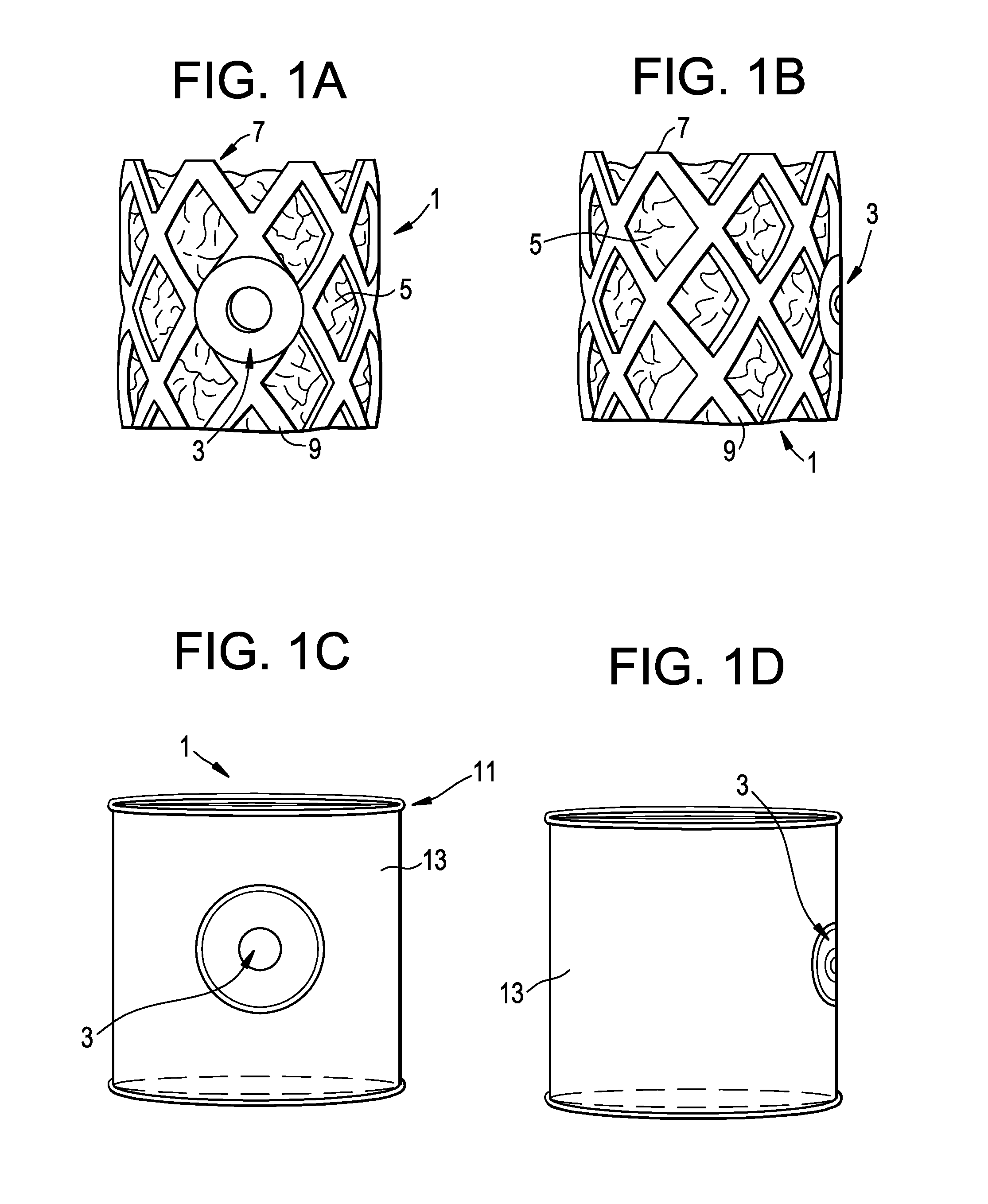 Aspirating Implants and Method of Bony Regeneration