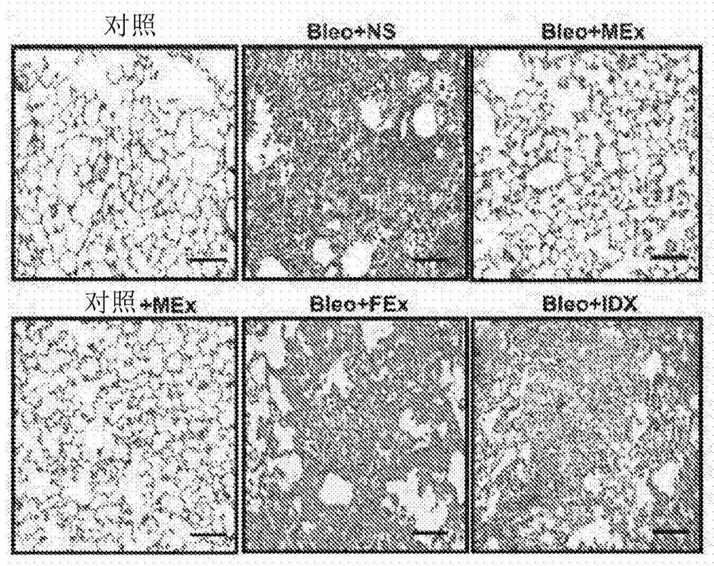 Mesenchymal stromal cell exosome -treated monocytes and uses thereof