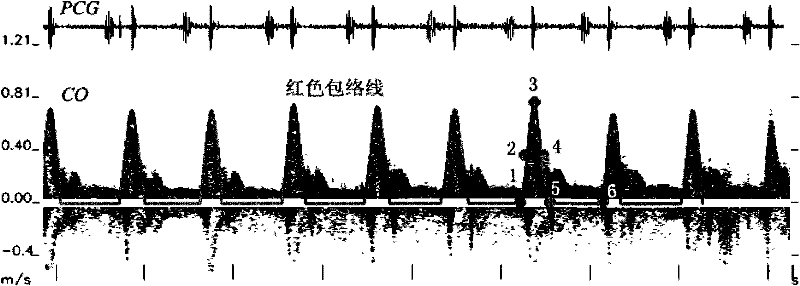 Method for recognizing ultrasonic spectrum enveloped peaks by combining cardiac sound