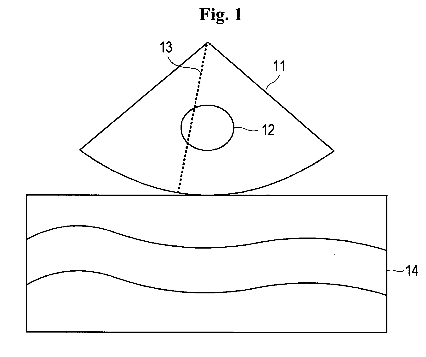 Ultrasound diagnostic system and method of forming arbitrary M-mode images