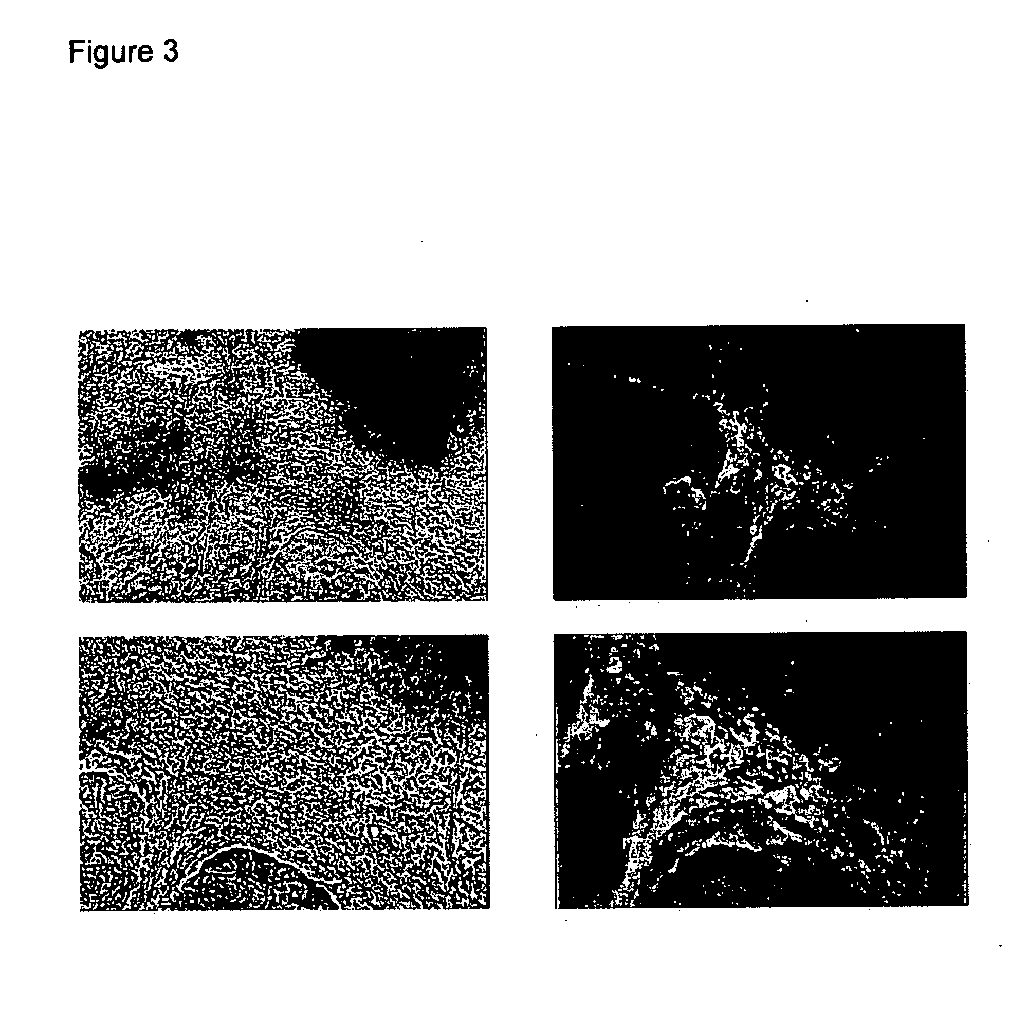 Differentiated cells suitable for human therapy