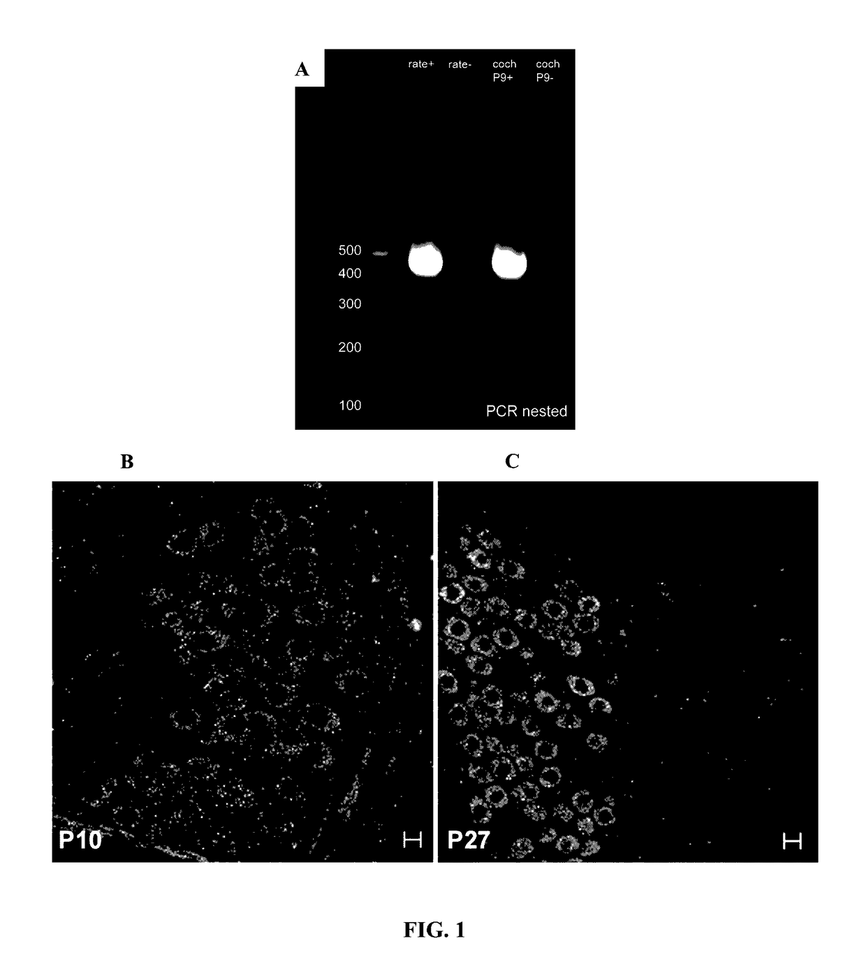 H4 receptor inhibitors for treating tinnitus