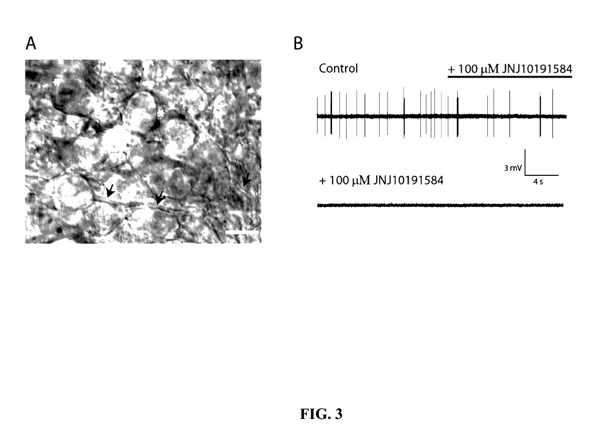 H4 receptor inhibitors for treating tinnitus