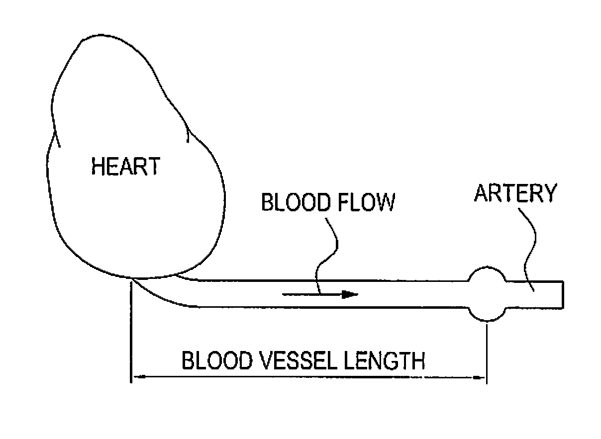 Blood pressure measuring apparatus and method for measuring blood vessel elasticity