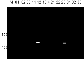 shRNA lentiviral expression vector for specifically inhibiting hepatic cell CYP2E1 gene expression, constructing method and application thereof