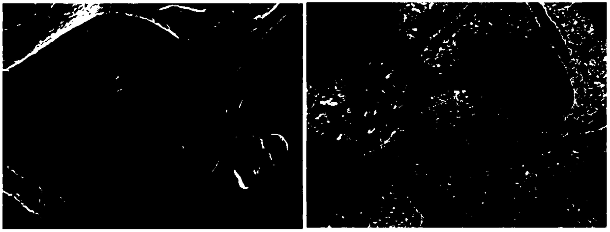 A surface dendrite-free high-safety metal lithium anode and preparation method and application thereof