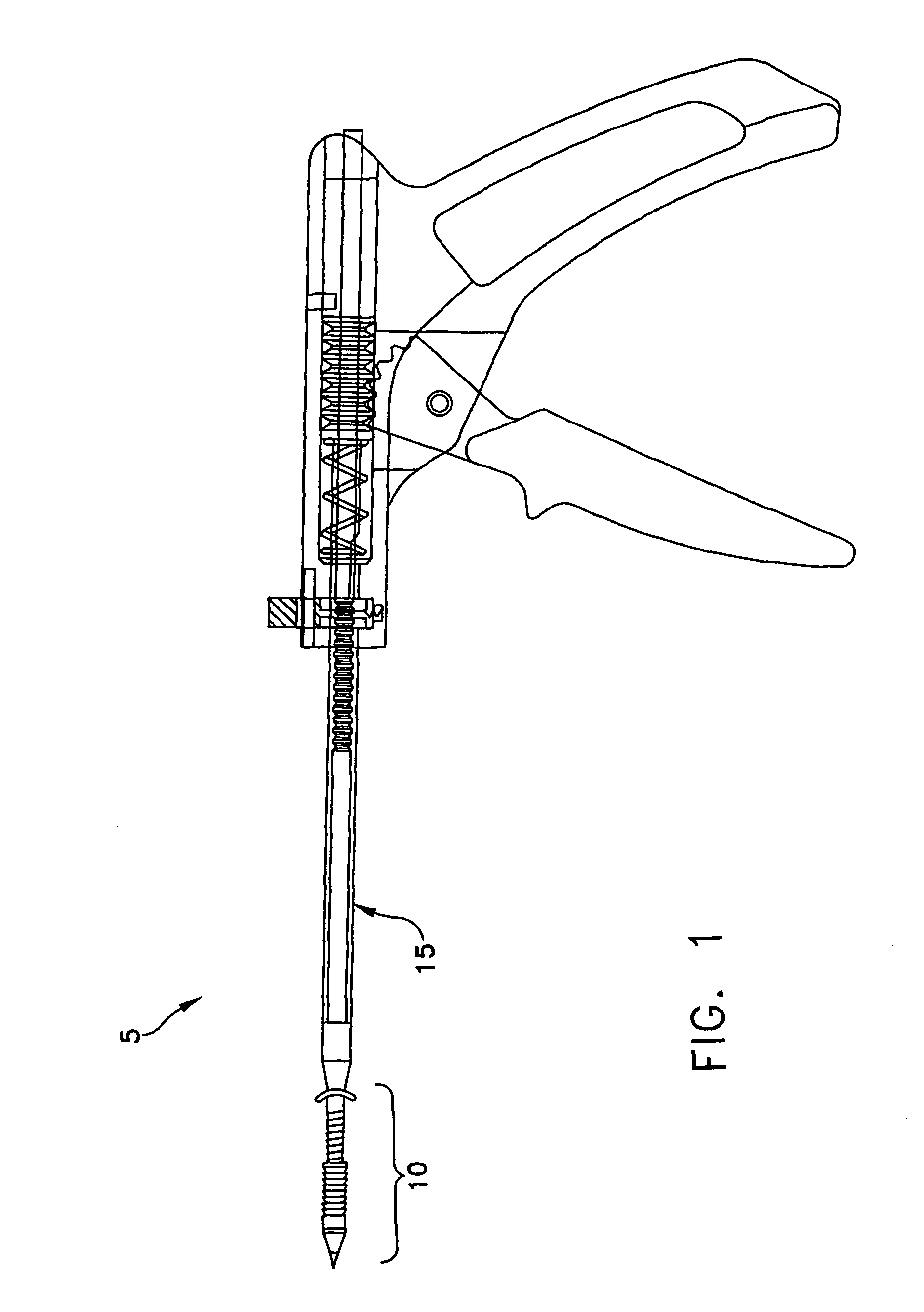 Apparatus and method for attaching soft tissue to bone
