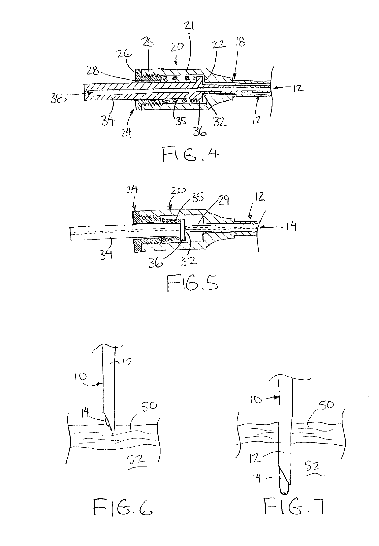 Modified veress needle for use in peritoneal dialysis catheter insertion