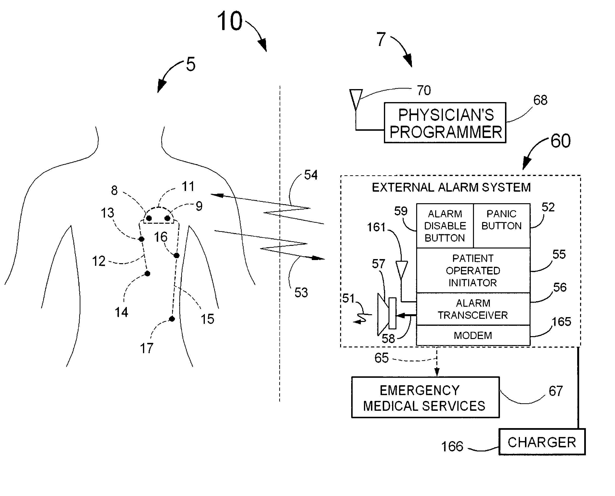 System for detection of different types of cardiac events