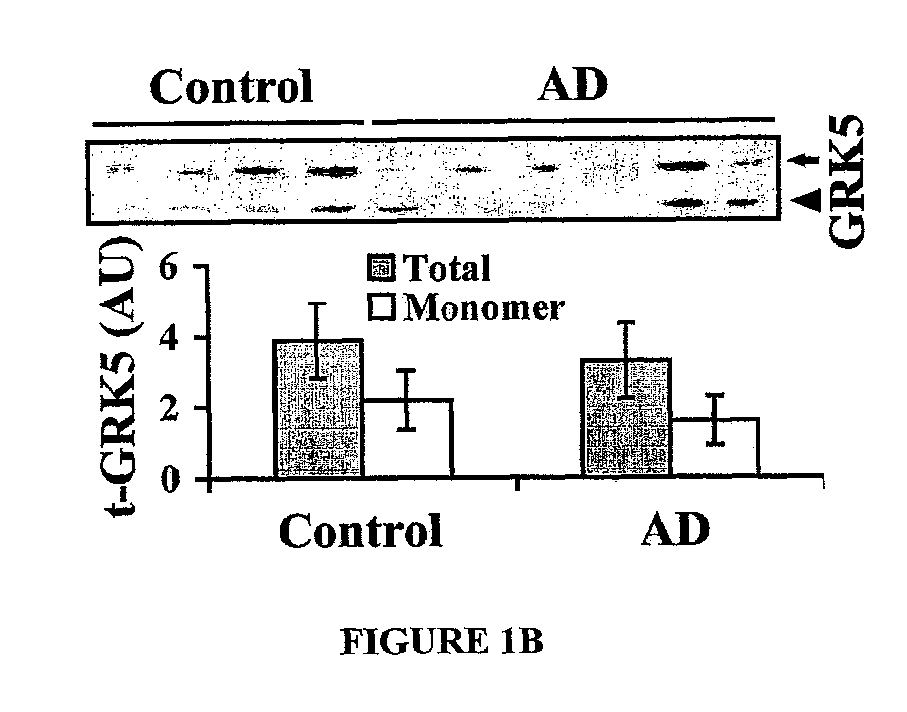 Method of detecting and preventing Alzheimer's disease, particularly at prodromal and early stages