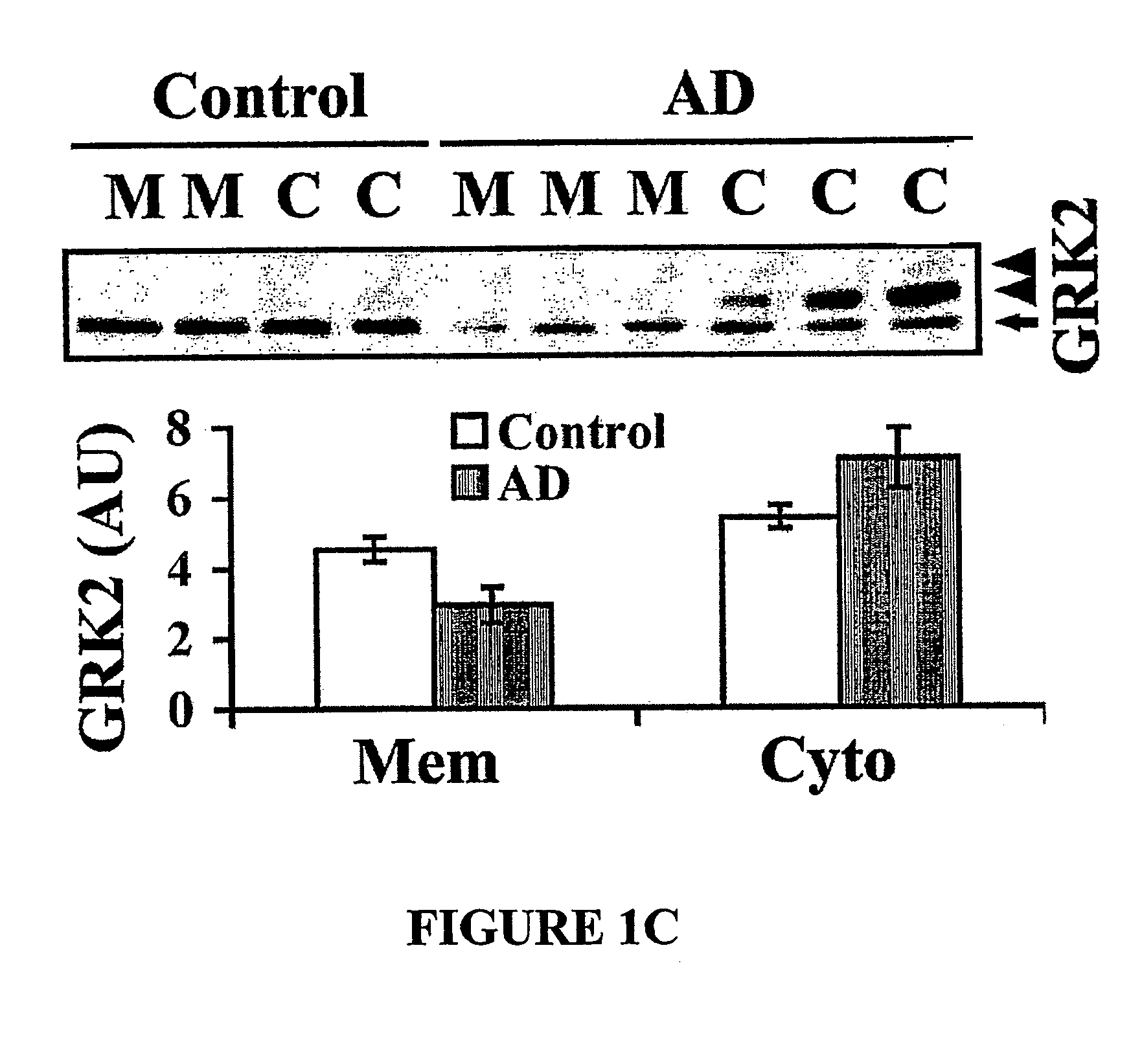 Method of detecting and preventing Alzheimer's disease, particularly at prodromal and early stages