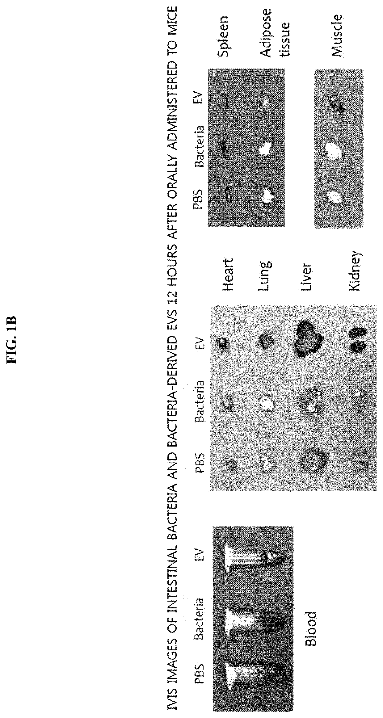 Method for diagnosing cholangiocarcinoma via bacterial metagenomic analysis