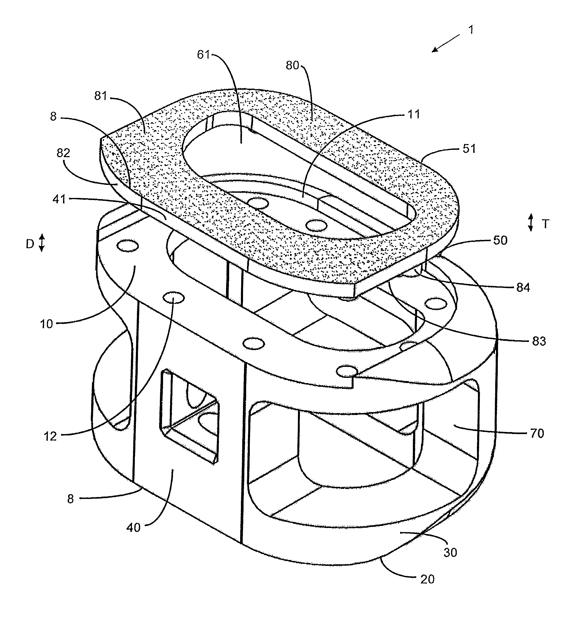 Endplate-preserving spinal implant with an integration plate having durable connectors