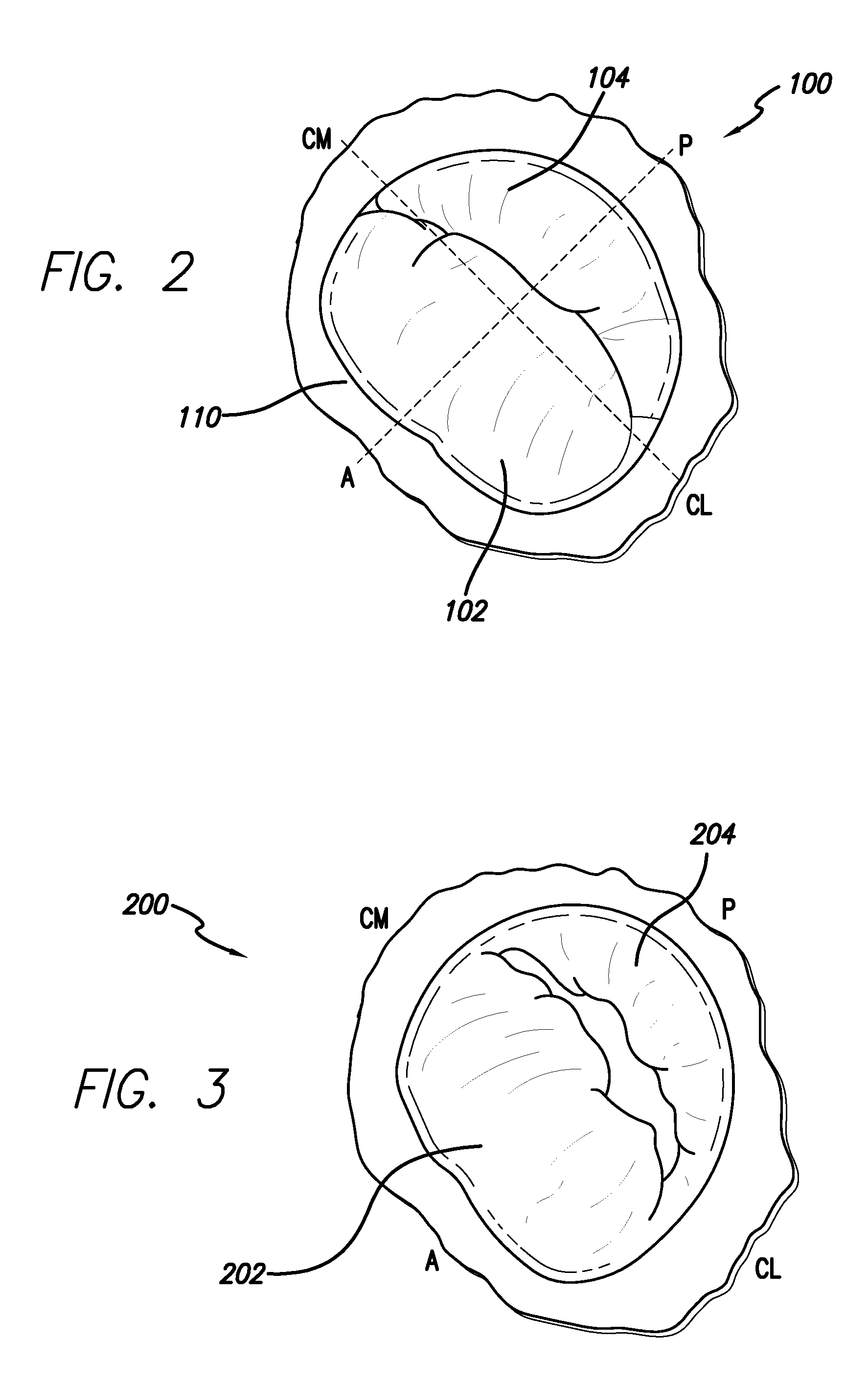 Methods and devices for performing cardiac valve repair