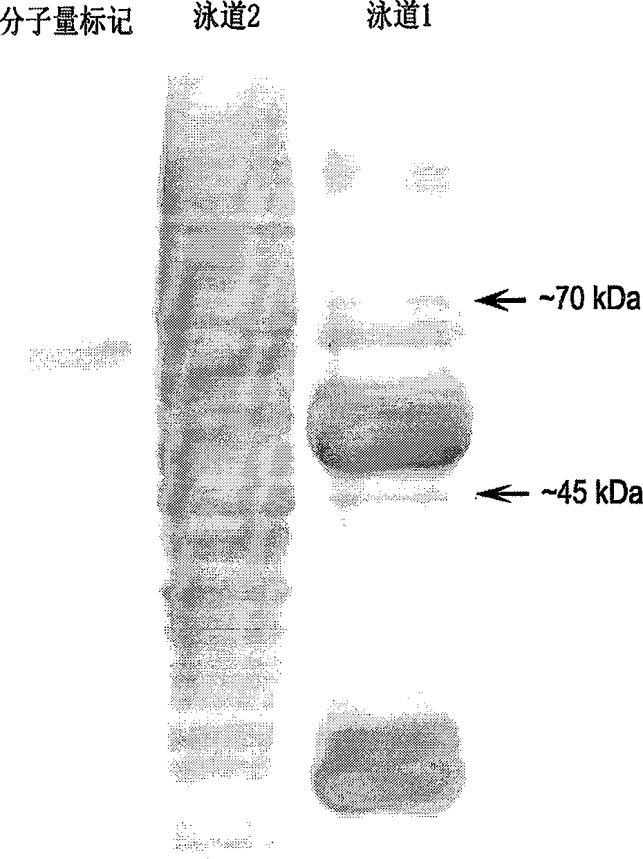 Method for detecting id marks related to tumor in blood serum from patient of oesophagus cancer