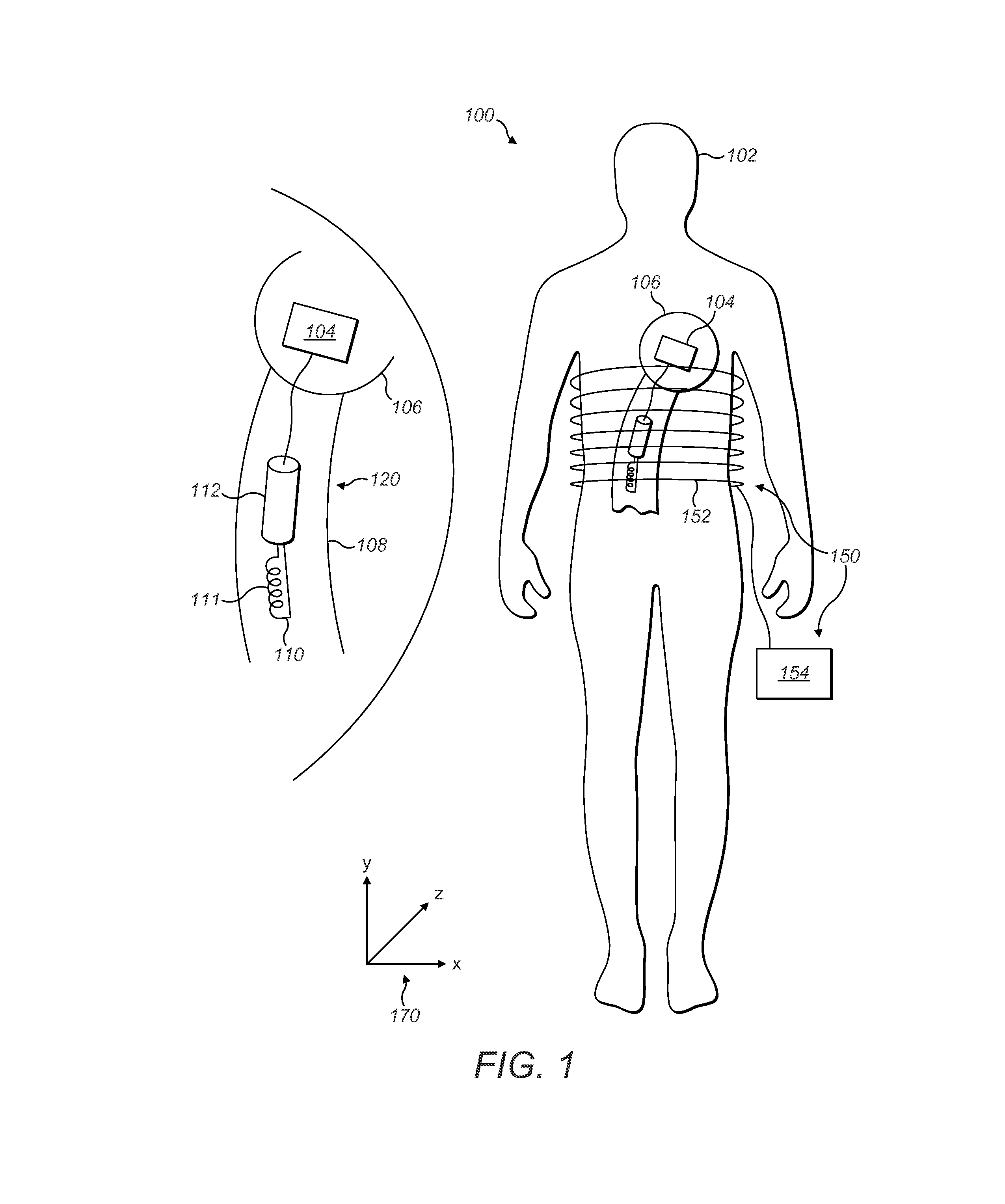 Apparatus for contactless power transfer in implantable devices