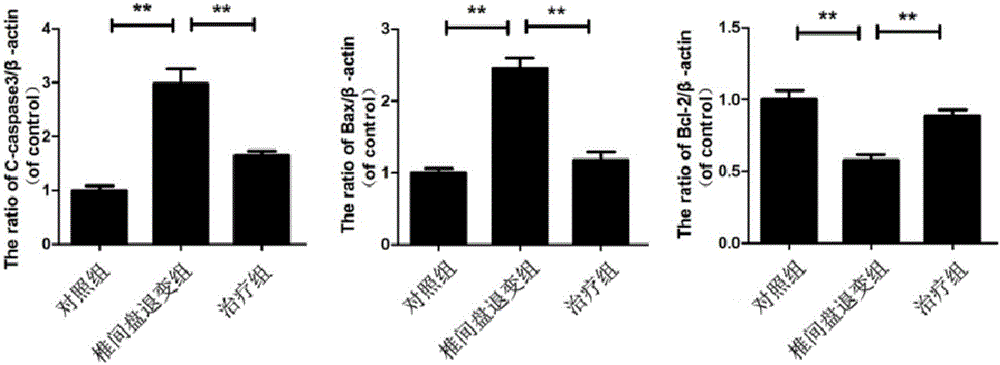 Application of dimethyldiguanide as active component in medicine for treating disc degeneration disease