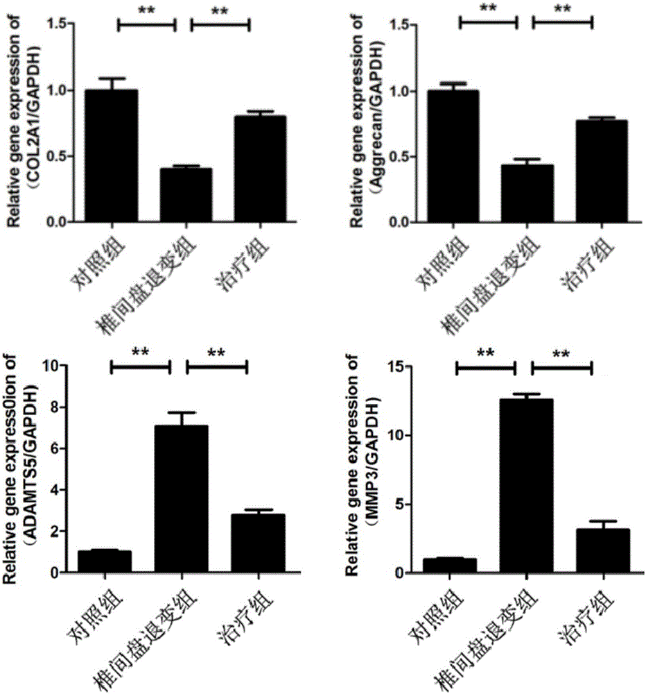 Application of dimethyldiguanide as active component in medicine for treating disc degeneration disease