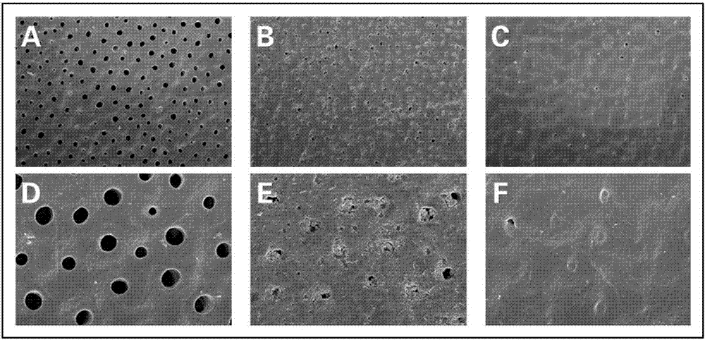 Tooth remineralization toothpaste and preparation method thereof