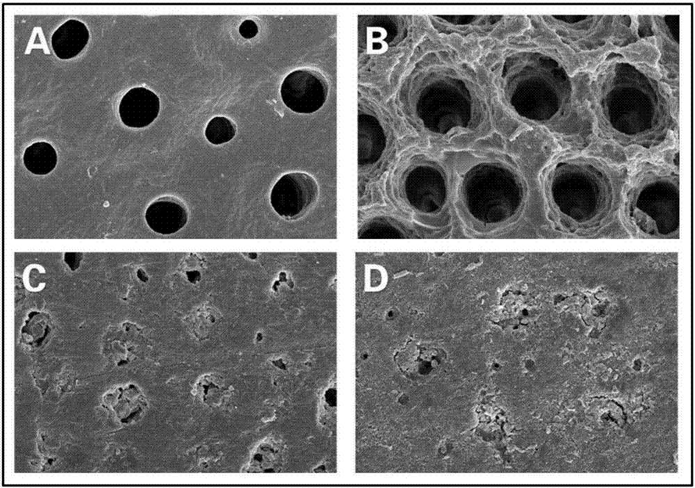 Tooth remineralization toothpaste and preparation method thereof