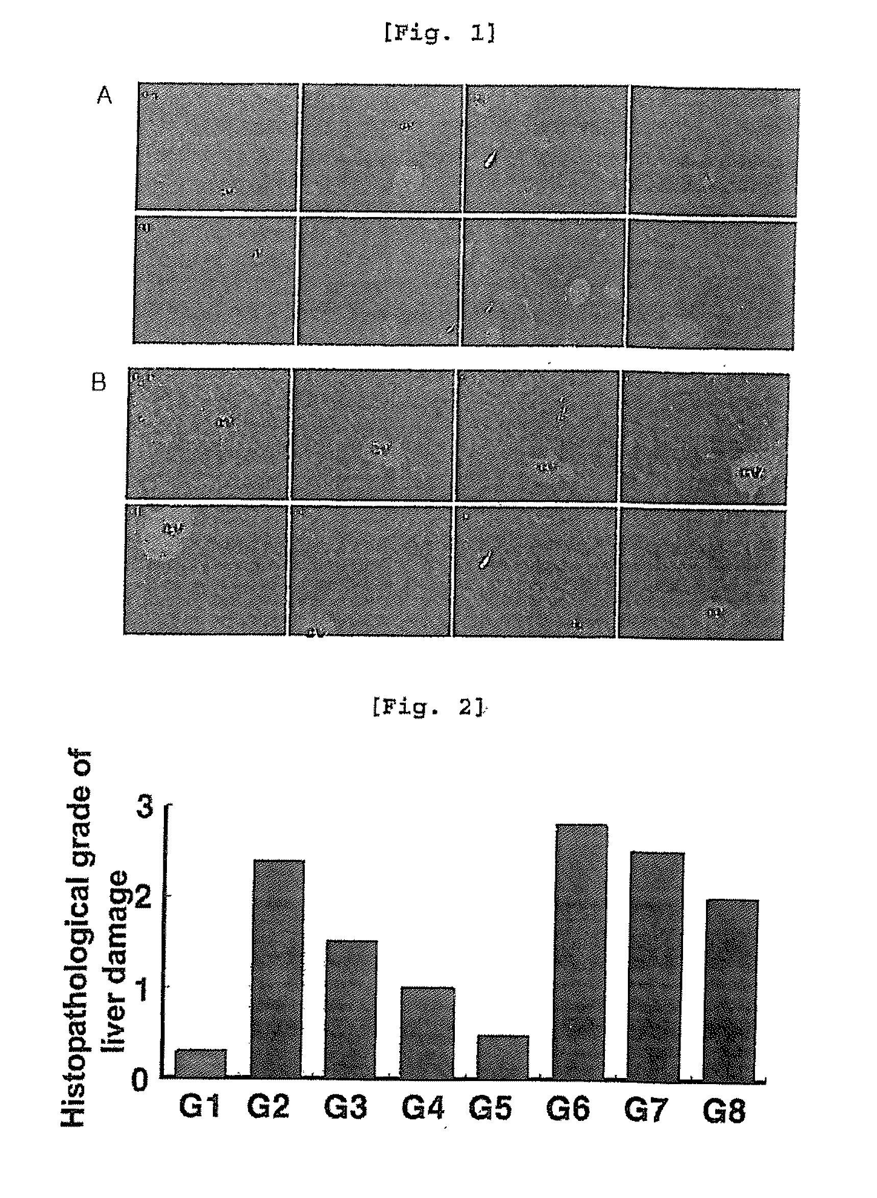 Pharmaceutical composition containing arazyme for the prevention of liver dysfunction