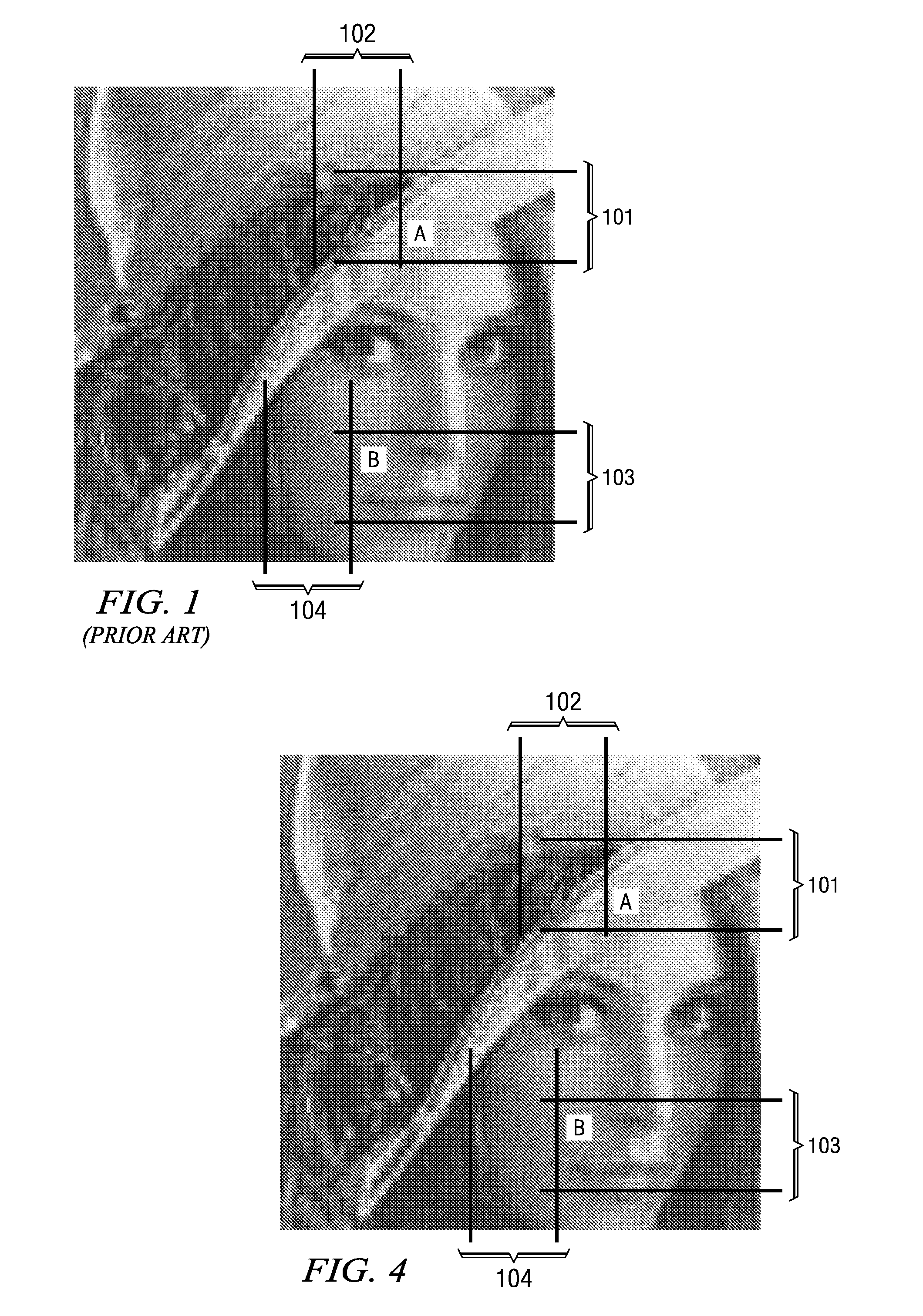 Post-processing technique for noise reduction of DCT-based compressed images