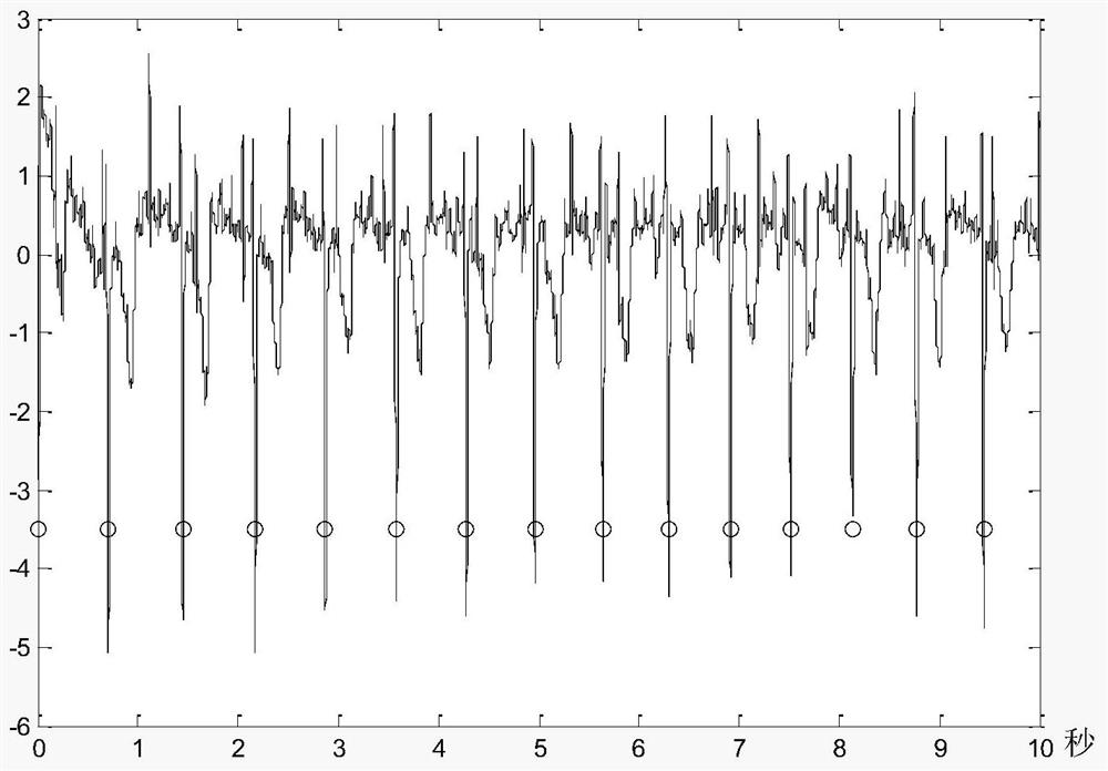 Fetus electrocardiosignal online extraction system and method