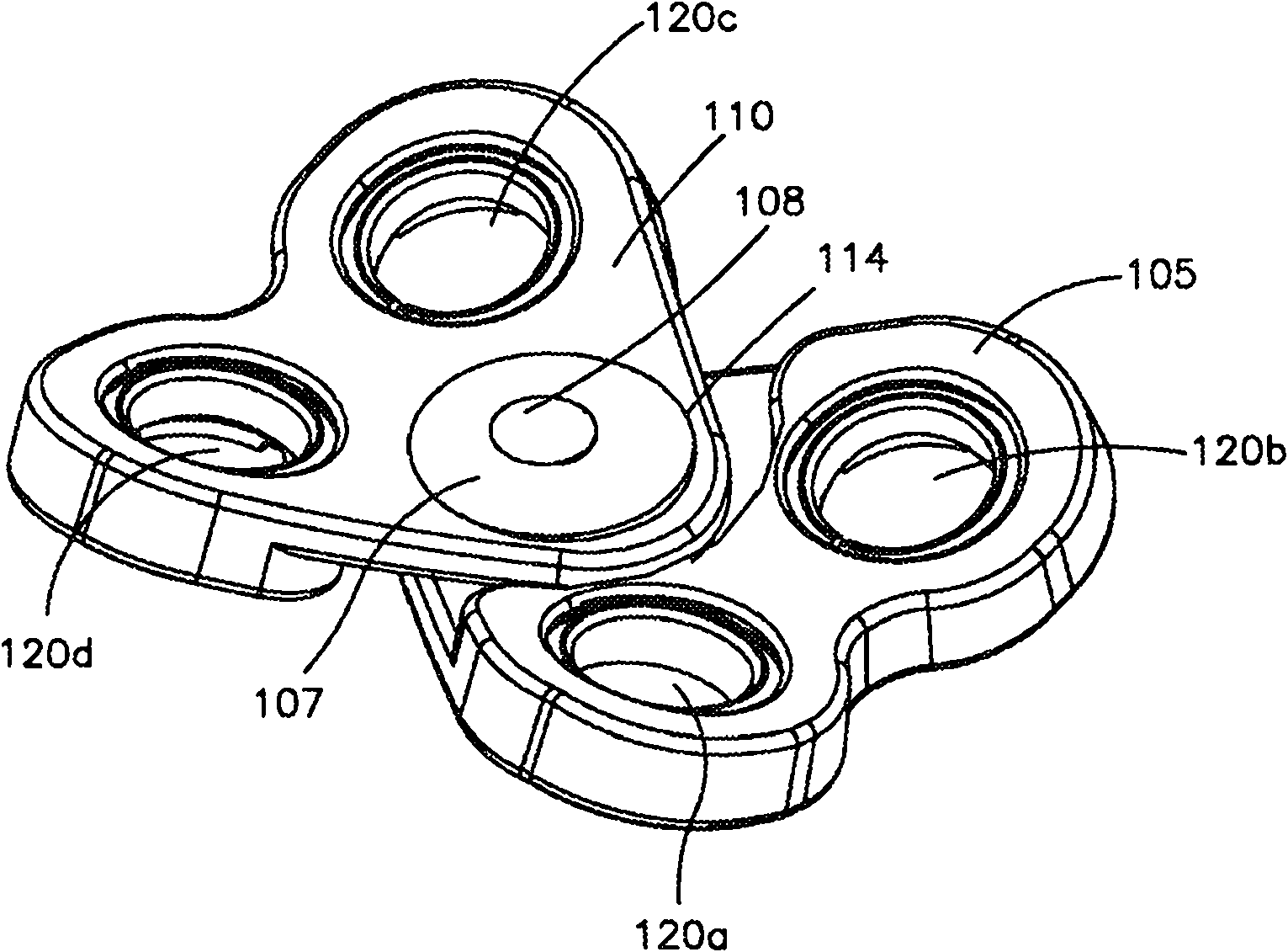 Anterior transpedicular screw-and-plate system