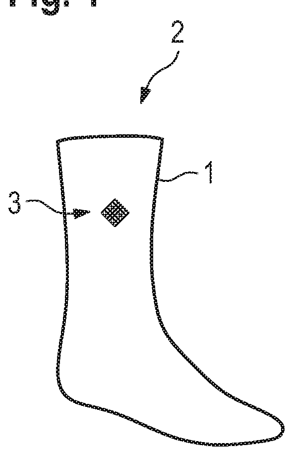 Compression knit part, compression garment, dyeing method for compression knit part, and production method for dyed compression garment