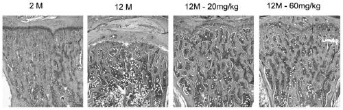 Application of deferoxamine mesylate for injection in treating senile bone loss and bone marrow stem cell aging
