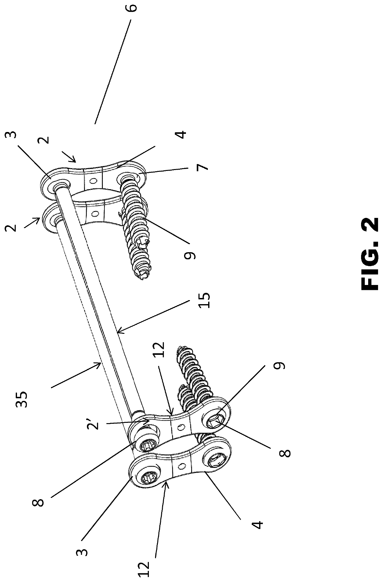 Inner fixation device for the treatment of a limb, in particular the femur distal portion or tibia proximal portion