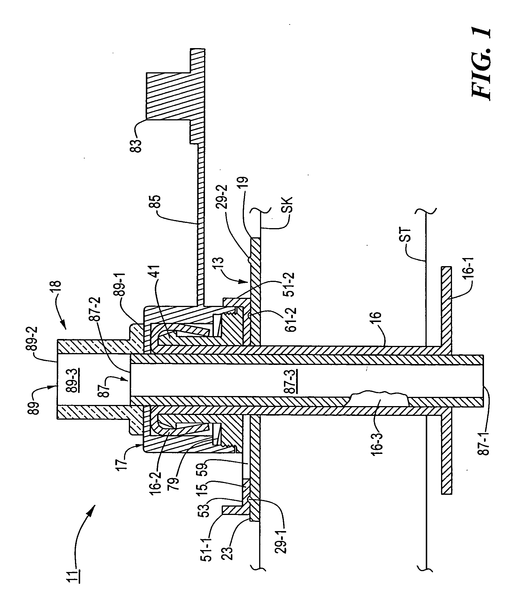 Medical catheter assembly including a removable inner sleeve and method of using the same