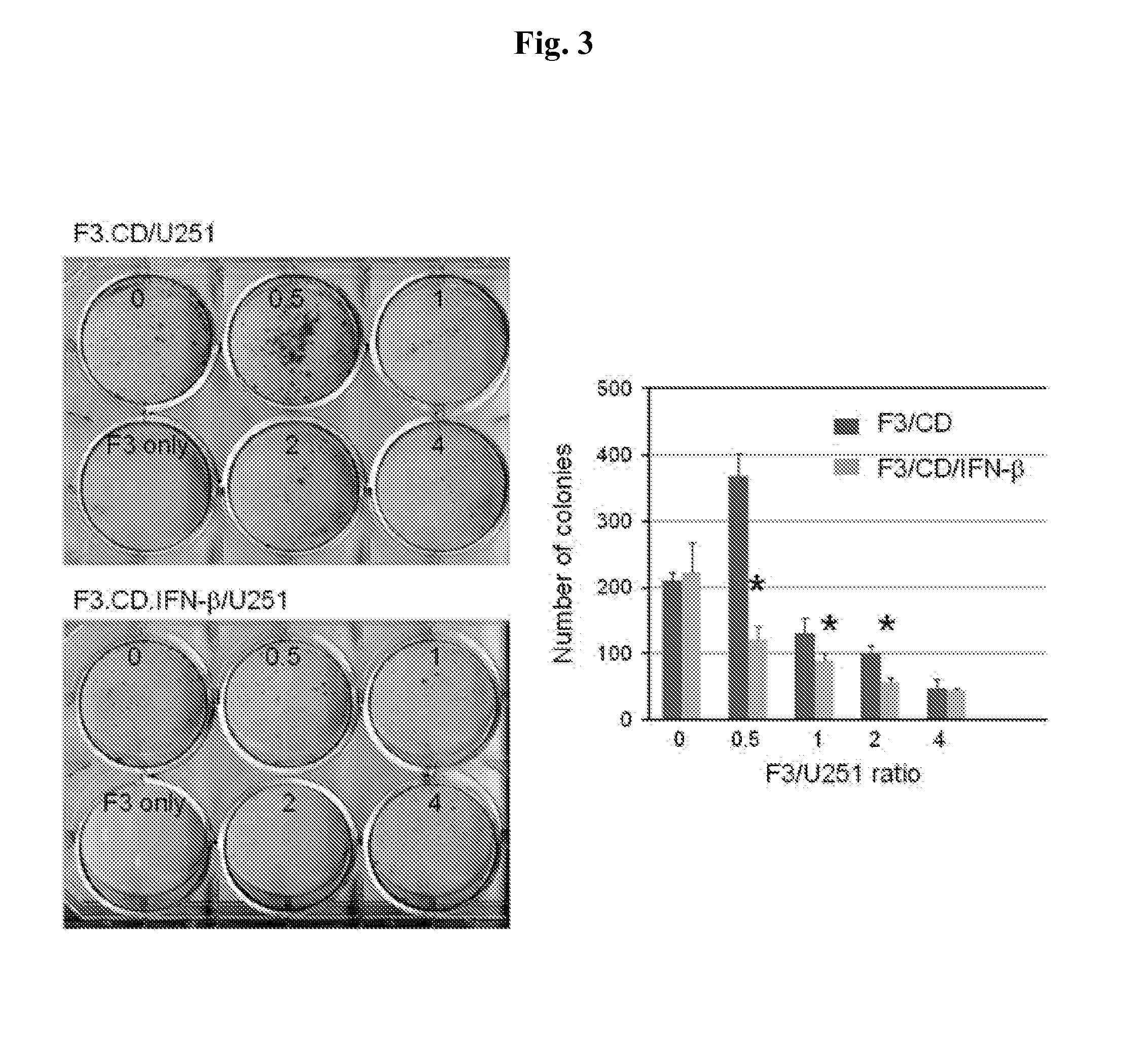 Neural stem cell composition capable of treating cancer and method of treatment