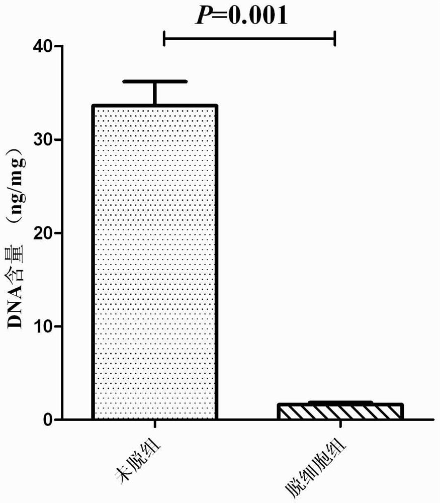 Construction method of human multiple myeloma microenvironment model based on bone decellularized scaffold