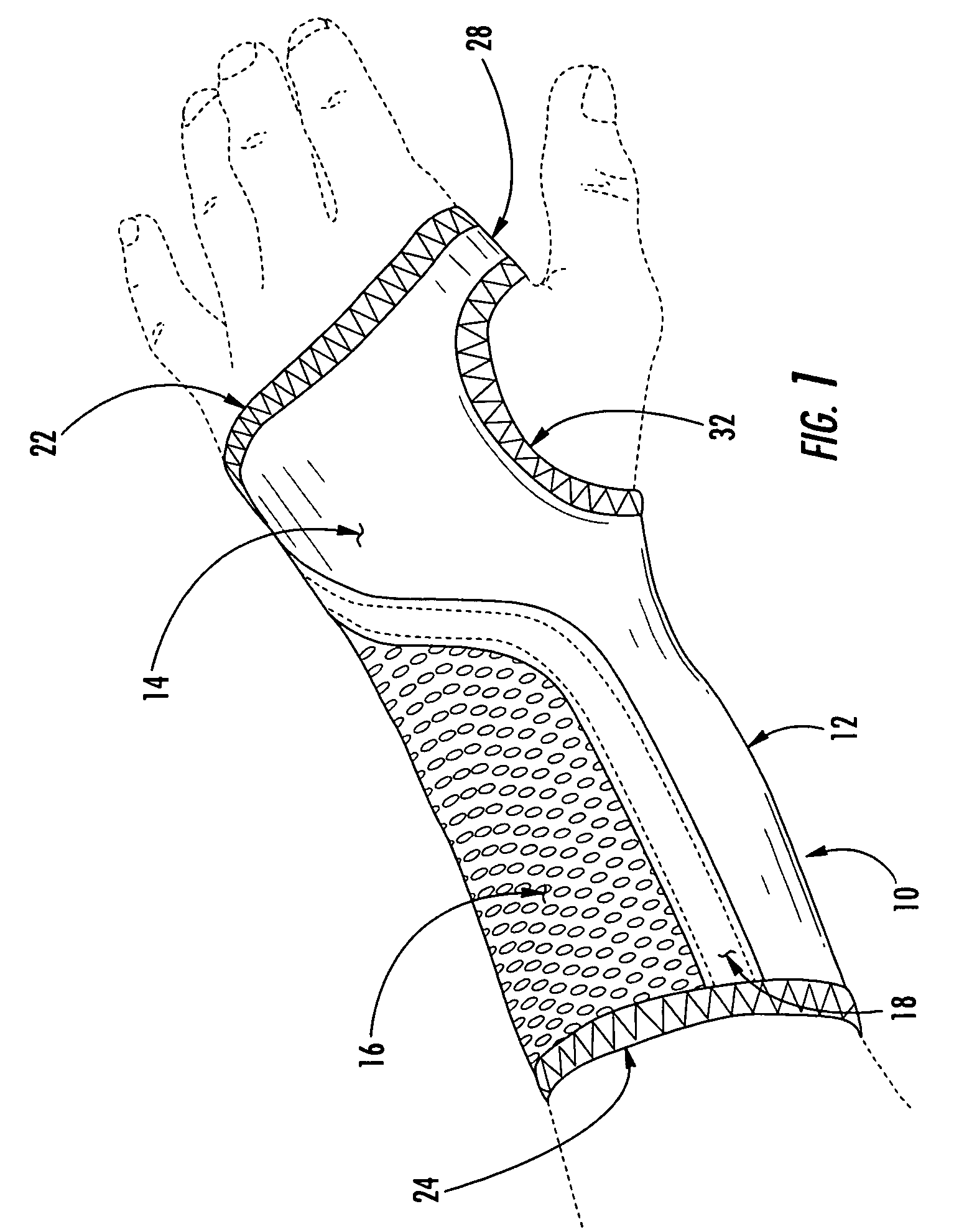 Wrist brace having continuous loop straps and method of using the same