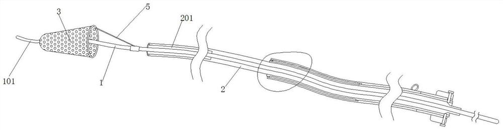 Internal carotid artery integrated release umbrella protection stent