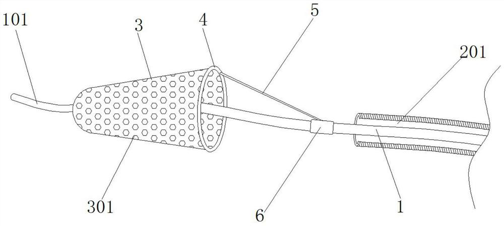 Internal carotid artery integrated release umbrella protection stent