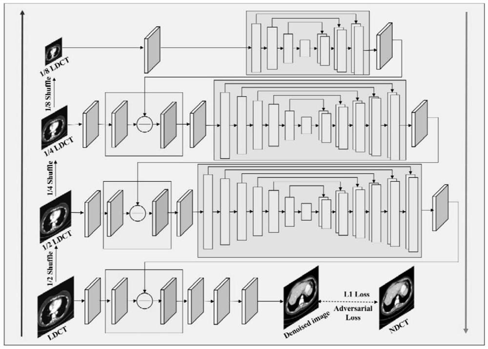 Multi-scale feature generative adversarial network for suppressing artifact noise in low-dose CT image