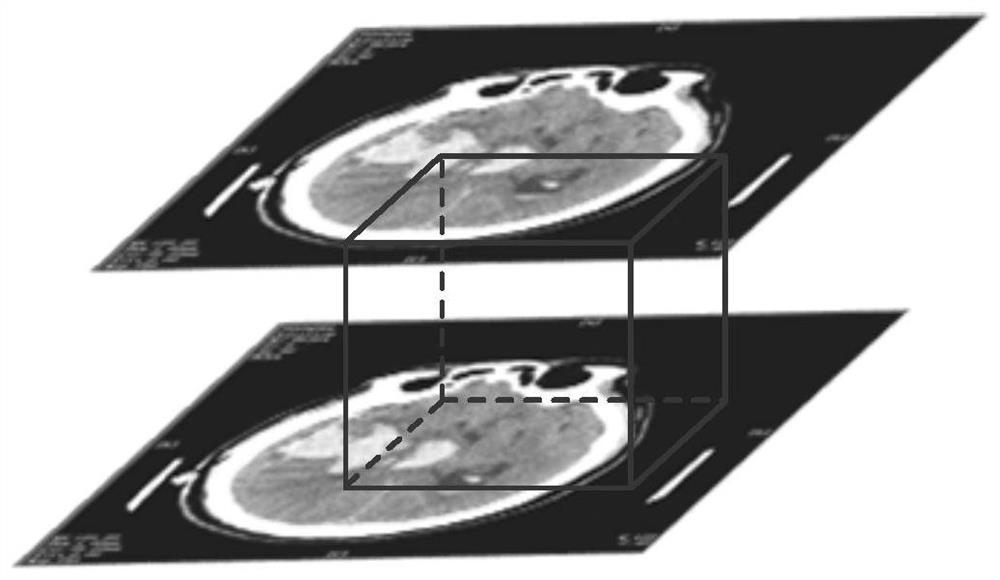 CT image three-dimensional reconstruction method based on MC-T algorithm