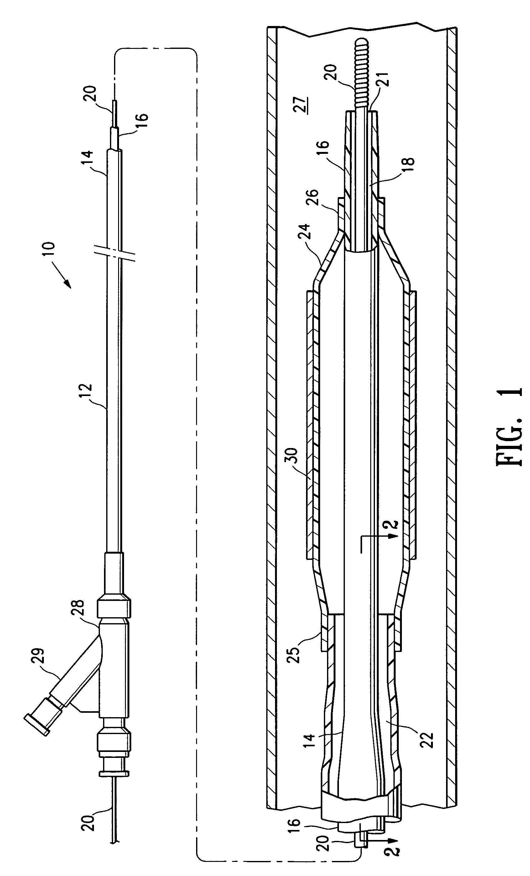 Balloon catheter having a multilayered shaft with variable flexibility