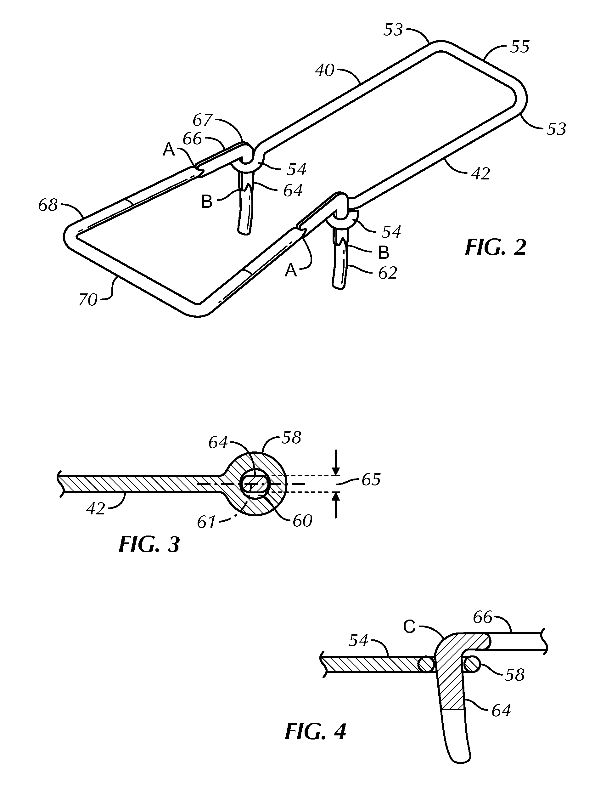 High-strength partially compressed veneer ties and anchoring systems utilizing the same