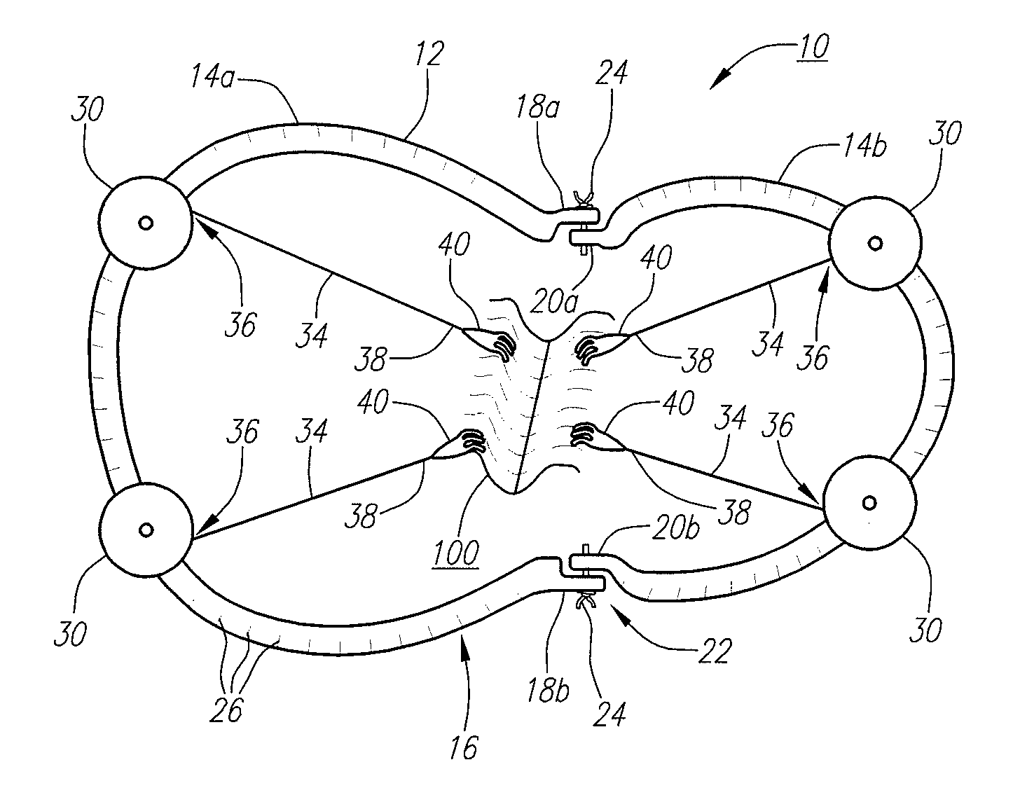 Surgical retractor device and method of use